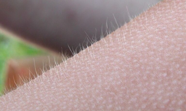 Científicos observan en el cerebro los famosos “escalofríos musicales”