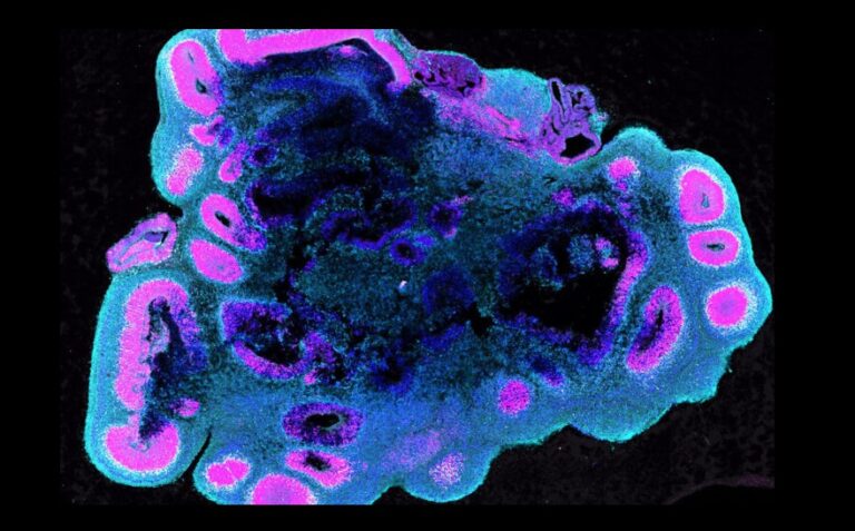 Los cerebros humanos son grandes gracias a este interruptor neurológico