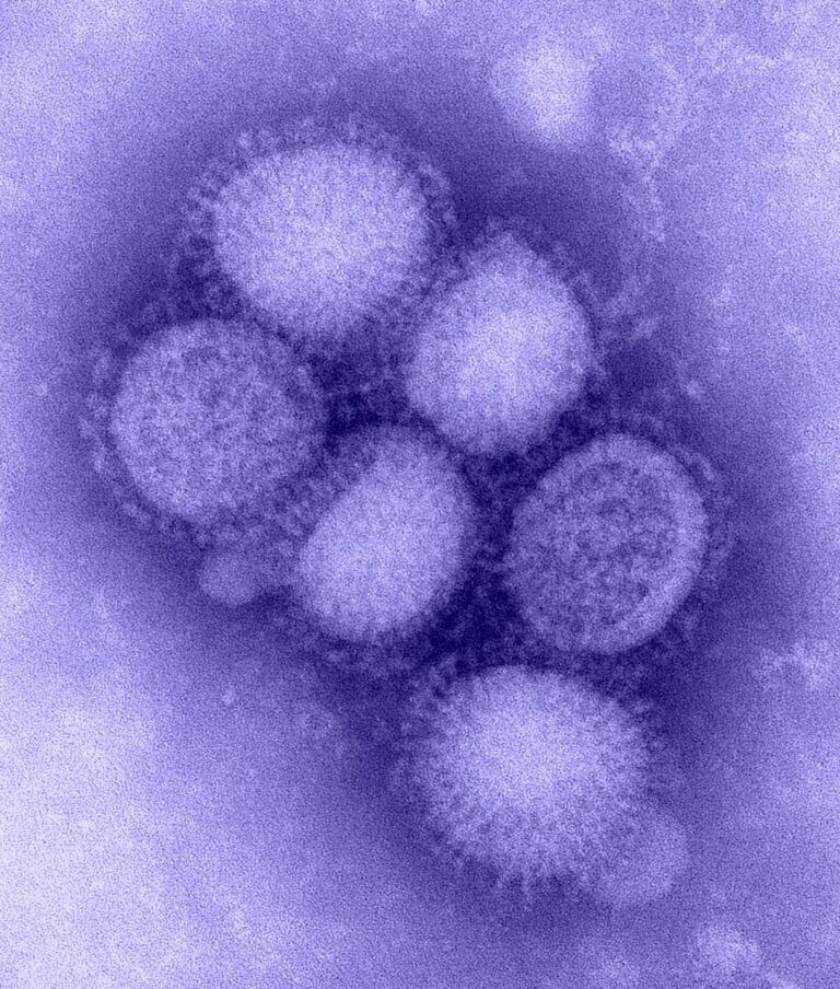 Medidas contra la pandemia han reducido la diversidad de virus de la influenza