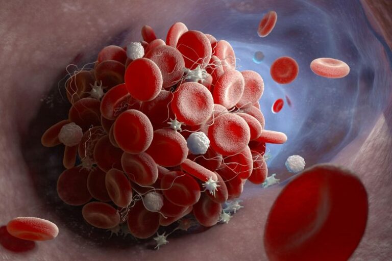 Esta es la razón por la cual pacientes con Covid-19 severo sufren anomalías en la coagulación sanguínea