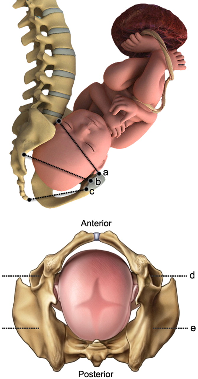 Esta es la razón por la que tenemos un canal de parto retorcido, según nuevos modelos biomecánicos