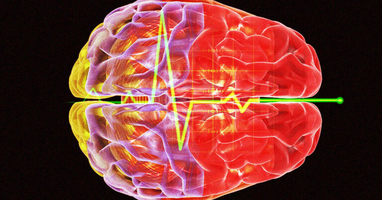 Se registra por primera vez y al detalle la actividad cerebral de una persona mientras fallece