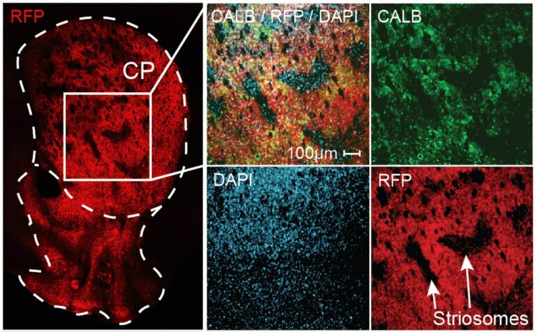 Neurocientíficos identifican las neuronas que sopesan los resultados de las decisiones