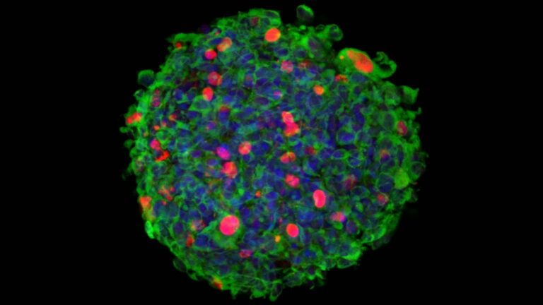 Un nuevo ensayo clínico probará un virus que ataca células cancerosas