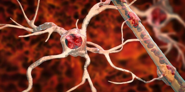 Una molécula muy común estaría relacionada con la esclerosis lateral amiotrófica
