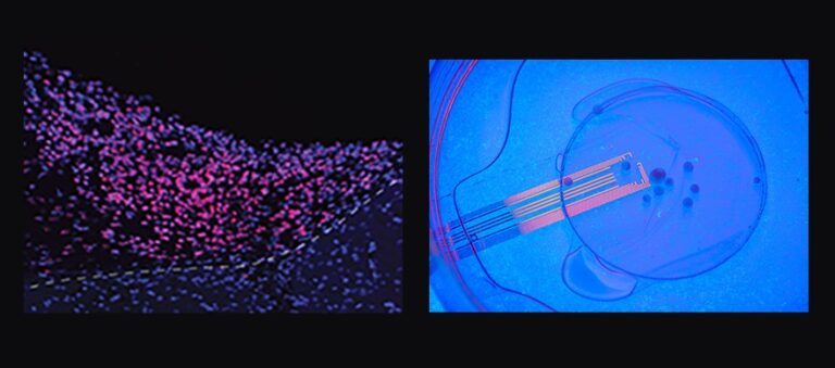 Minicerebros humanos implantados en ratones logran detectar impulsos visuales por primera vez