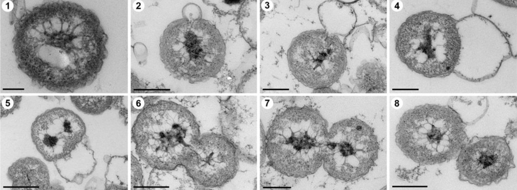 Científicos descubren una nueva cepa de bacteria en el fondo marino que coexiste con su enemigo natural