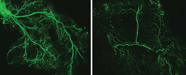 Científicos logran retrasar el envejecimiento en ratones tras activar una célula cerebral