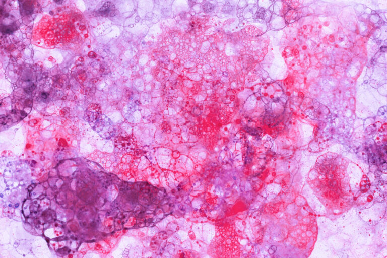 Científicos descubren un péptido que inhibe la propagación del cáncer