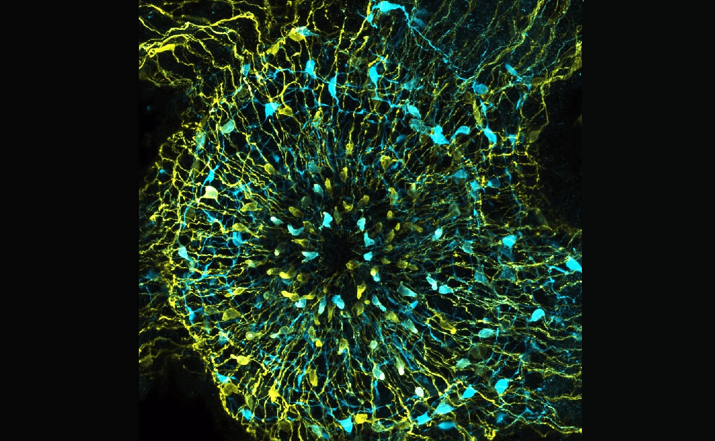 La compleja red neuronal de las hidras podría explicar el origen evolutivo del hambre