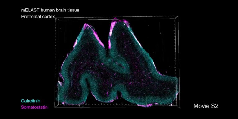 Científicos del MIT mapean completamente un hemisferio del cerebro humano