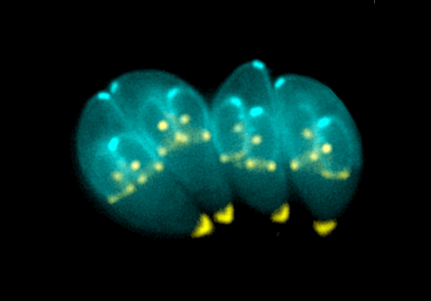 Este parásito podría usarse como tratamiento de enfermedades cerebrales