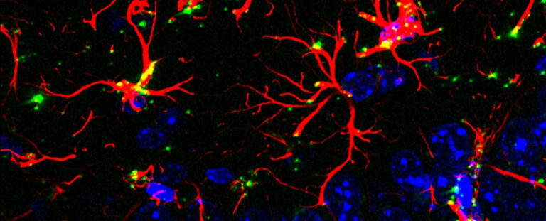 Científicos descubren una molécula que bloquea el envejecimiento y la demencia en ratones