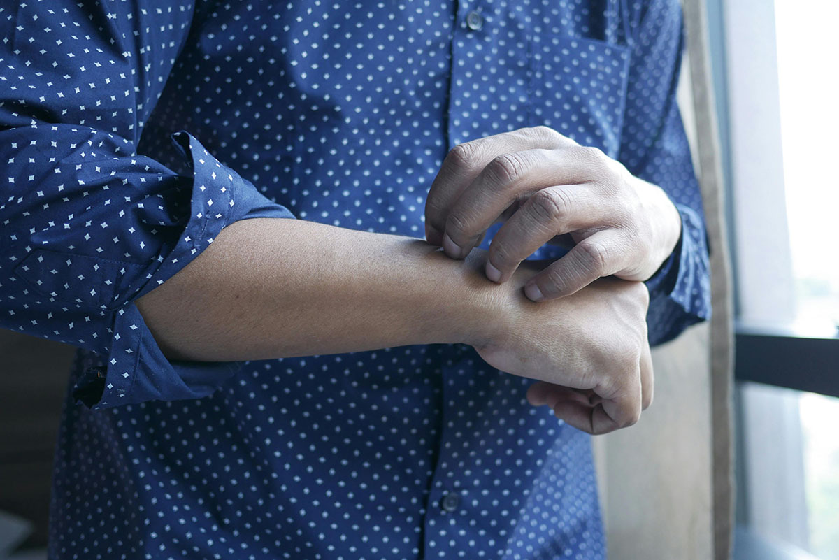 Los hongos en la piel podrían producir un potente antibiótico para combatir infecciones