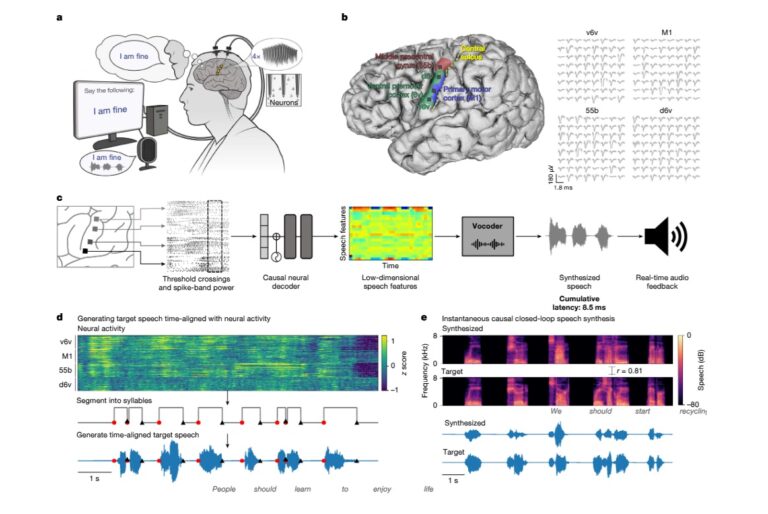 Este implante neuronal le permite hablar a una persona casi inmediatamente 