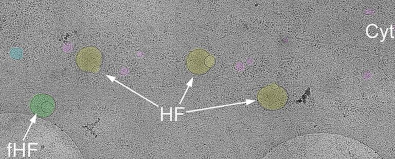 Descubren una nueva y misteriosa estructura oculta en las células humanas