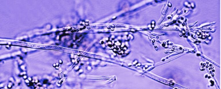 Vendajes hechos de hongos vivos podrían ser el futuro de la cicatrización de heridas