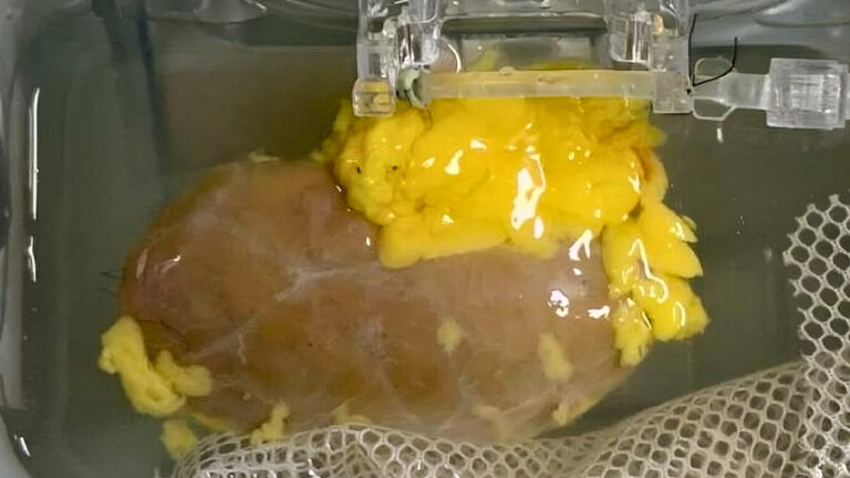 Científicos crean un riñón «universal» compatible con cualquier tipo de sangre