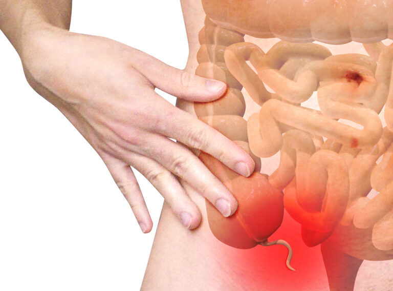 Un cáncer poco común está aumentando entre los jóvenes y los expertos están desconcertados