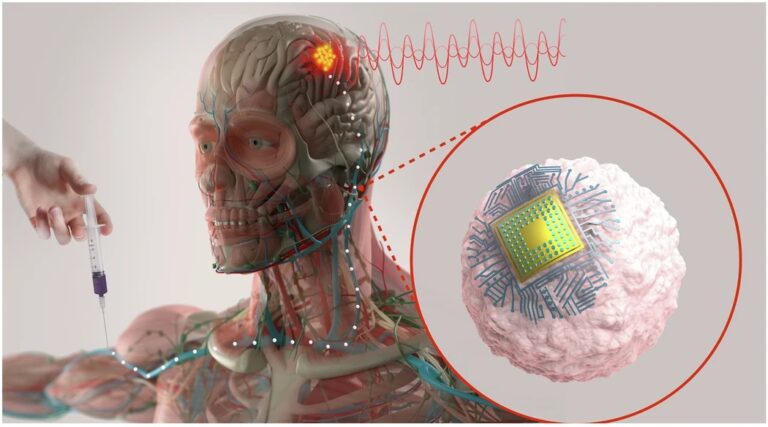 Este pequeño chip puede moverse en células inmunes para reducir inflamación