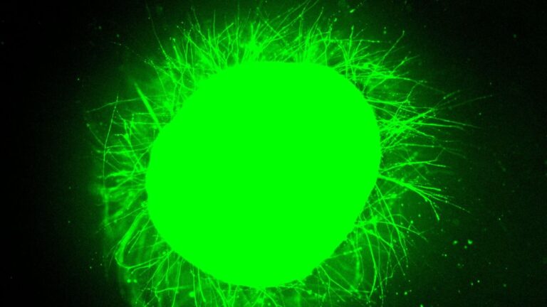 Científicos crearon médulas espinales humanas en miniatura y luego las repararon tras una lesión