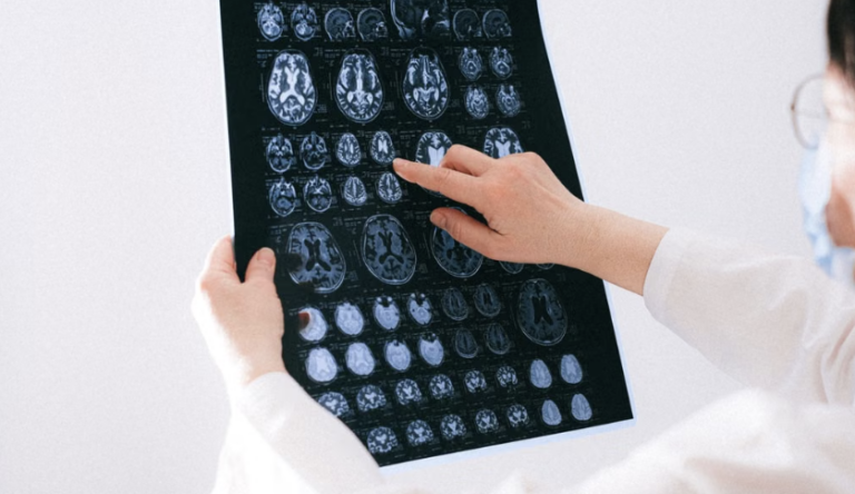 Científicos identifican dos subtipos distintos de autismo en el cerebro
