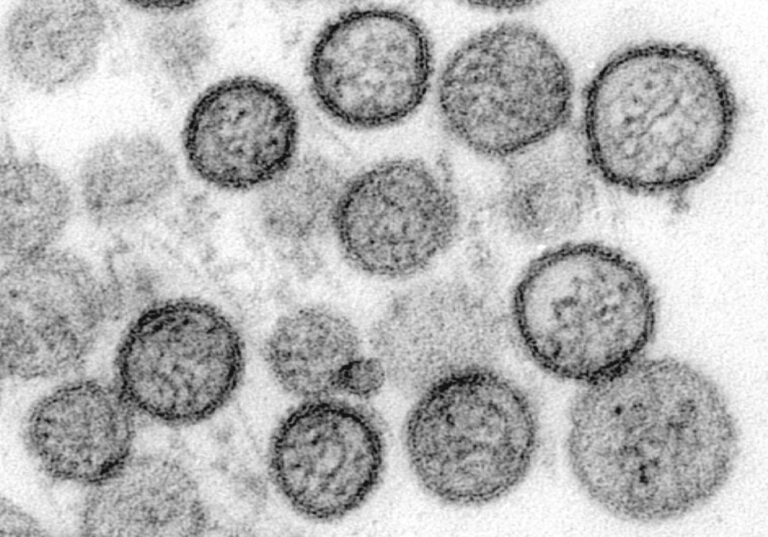 Moderna está trabajando en una vacuna contra el hantavirus