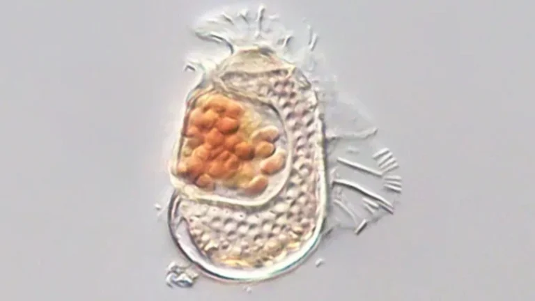 Descubren un microorganismo que desafía nuestra definición de vida